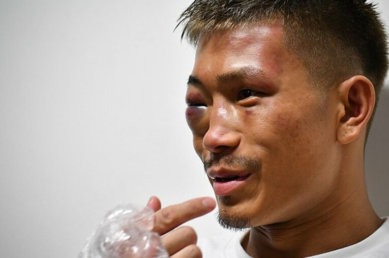 田中恒成「これだけ必死だったのは初の世界戦と木村さんの試合ぐらい」(2)