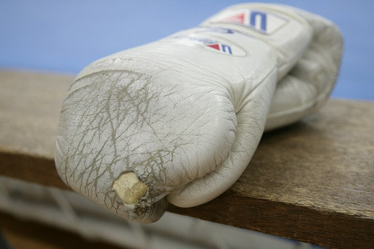 使い込まれた辰吉丈一郎のグローブ