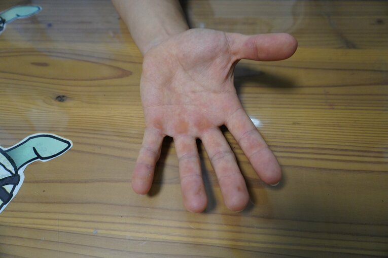 常人と比べると指の筋肉が顕著に発達している　©NumberWeb