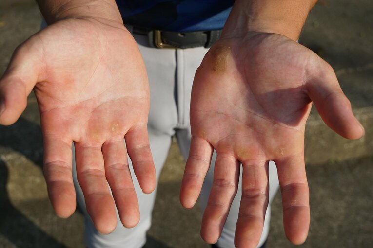 緒方漣の「手」　©Kei Nakamura