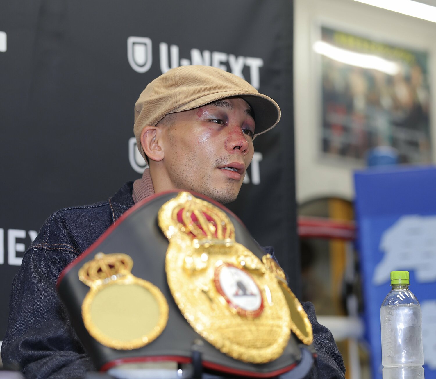 顔を晴らして会見に出席した堤聖也。骨折した鼻の手術を行い、サングラスすらもかけれない状況だった