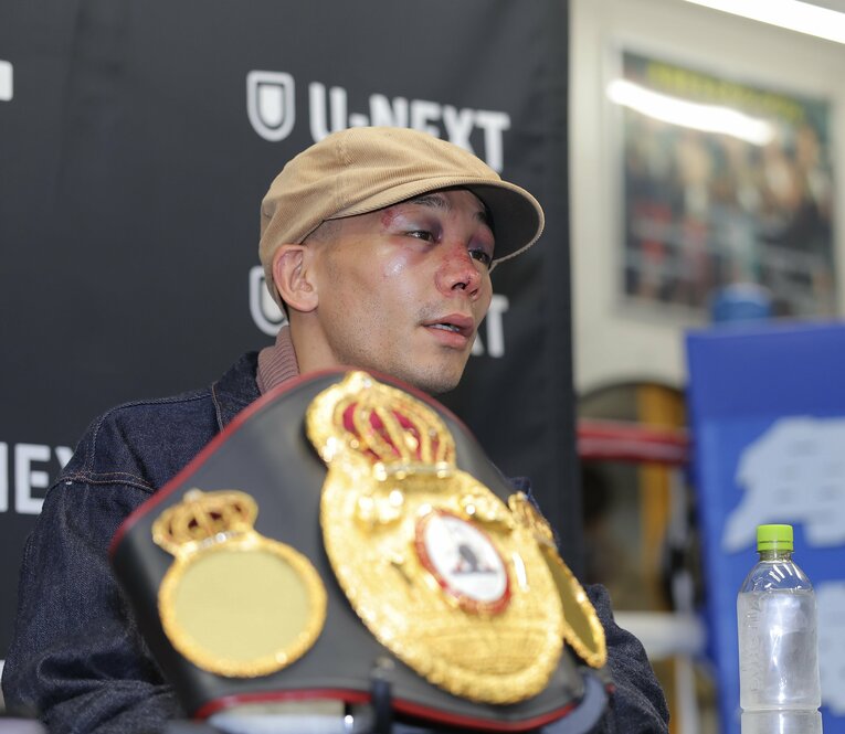 顔を晴らして会見に出席した堤聖也。骨折した鼻の手術を行い、サングラスすらもかけれない状況だった