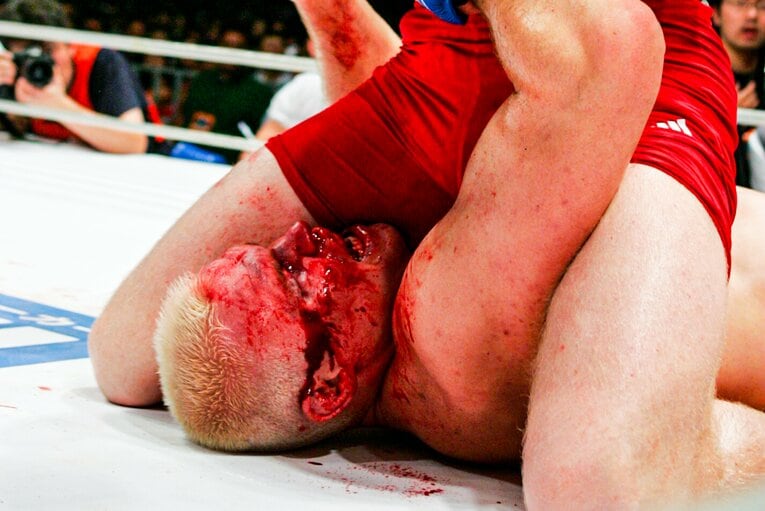 シュルトの血まみれの顔がモニターに映ると、客席から悲鳴があがった　©Susumu Nagao