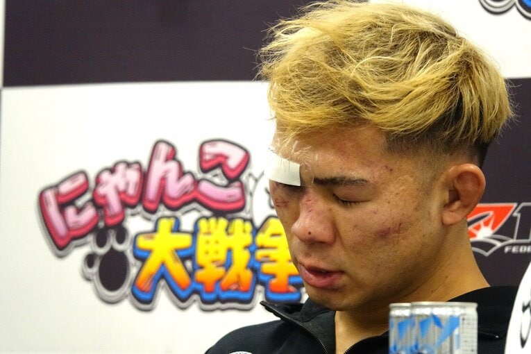 傷だらけの顔で試合後の会見に出席したYA-MAN　©Koji Fuse