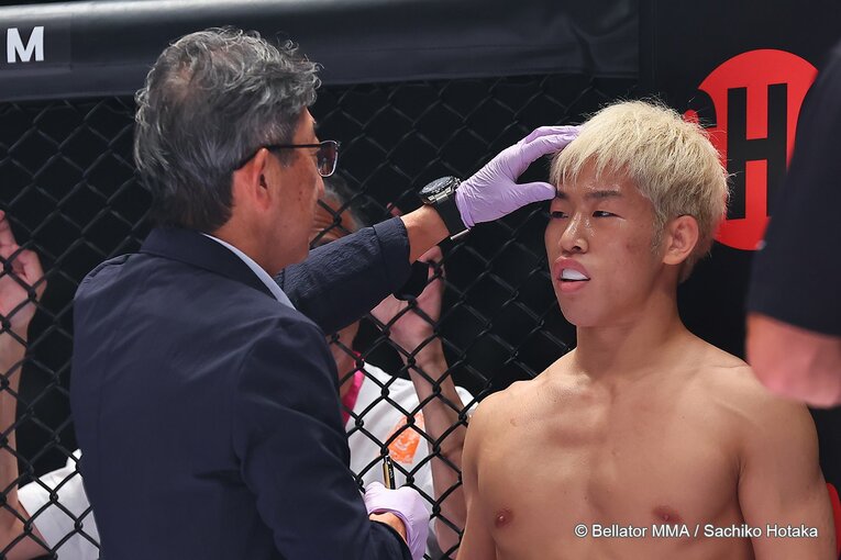 神龍の右目は見えなくなっていたという　©Bellator MMA／Sachiko Hotaka