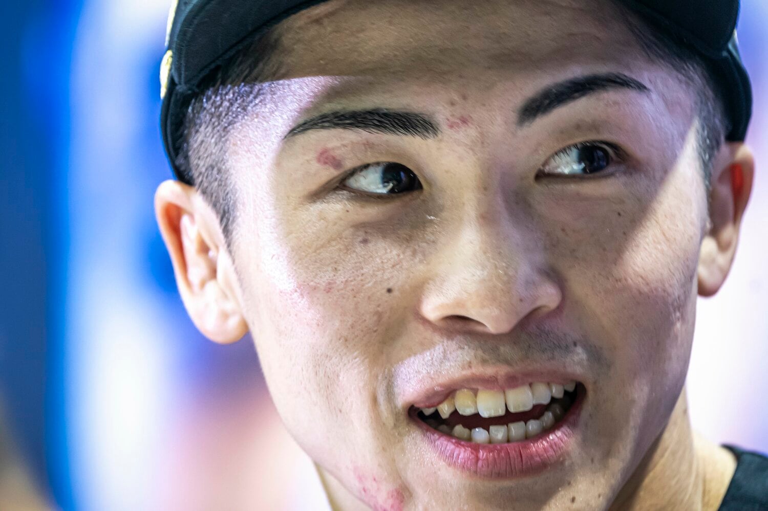 試合後の井上、右頬と額にわずかな傷があった　©Takuya Sugiyama