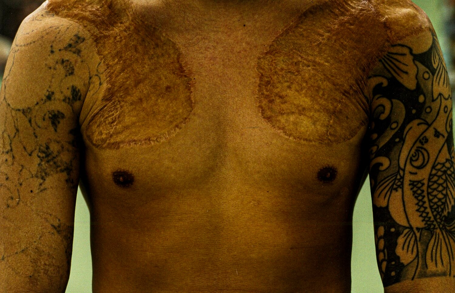 宏成はプロのリングに上がるため、皮膚を移植して入れ墨を消した ©︎Kenji Hayashi