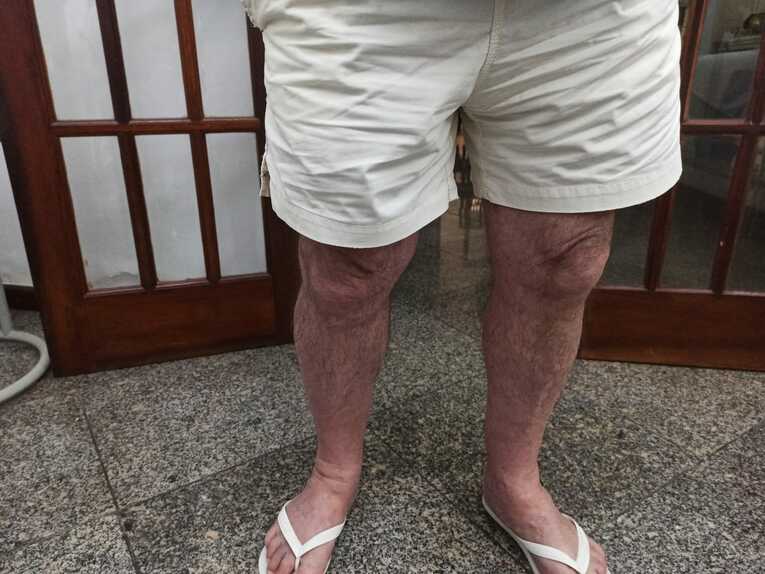 76歳とは思えぬ太い足！　©Hiroaki Sawada