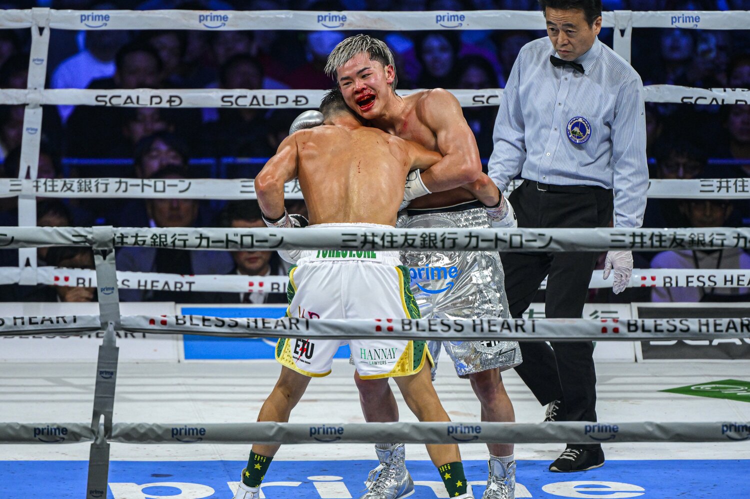 出血もあったが、実力者との一戦を楽しんでいるようにすら見えた那須川天心　©︎Takuya Sugiura