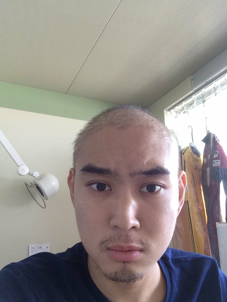 プロ入り後すぐに白血病を宣告された新潟DF早川史哉。3年半に及ぶ闘病生活を乗り越えてJリーグのピッチに戻ってきた