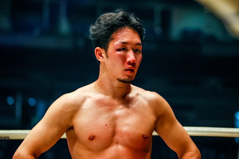 クレベル戦後、意識を取り戻した朝倉未来は呆然とした表情を浮かべる　©RIZIN FF Susumu Nagao