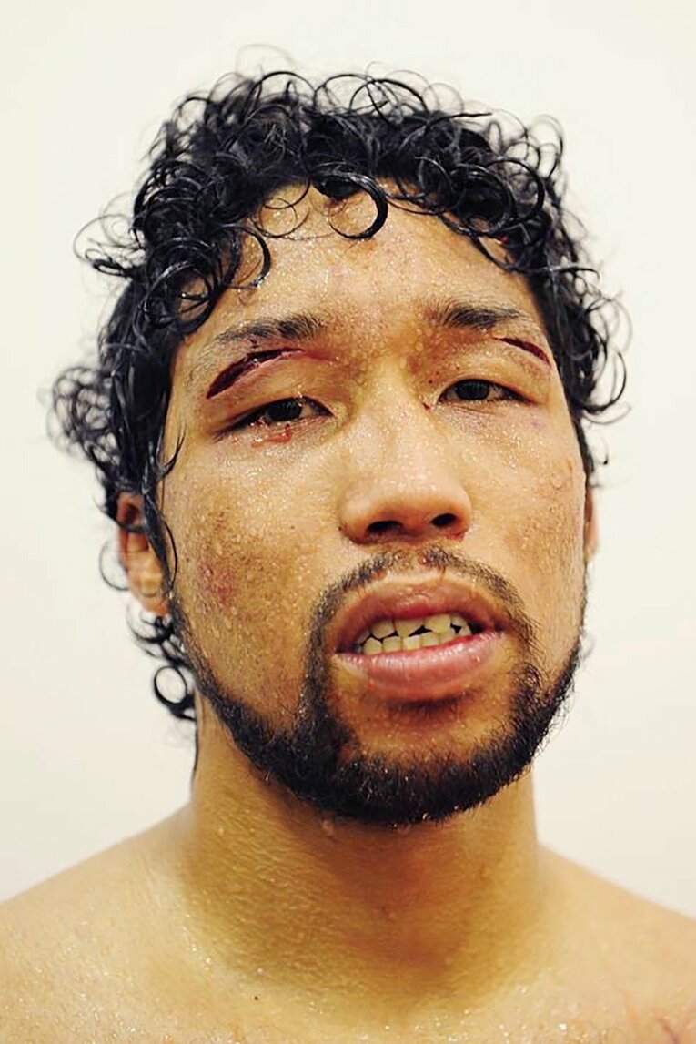 2016年7月、負傷判定で勝利。サウスポーのため目尻を切ることが多い　©Kokou Sekine