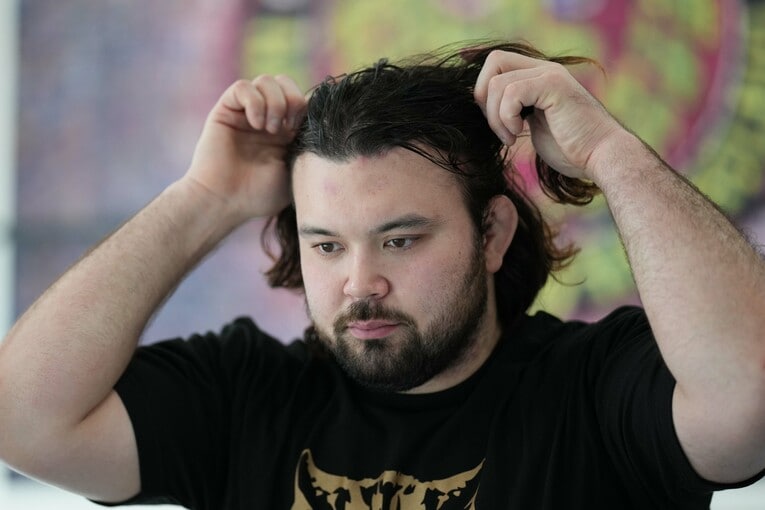 ウルフアロンはこの髪を短く刈るのだろうか？　©Essei Hara