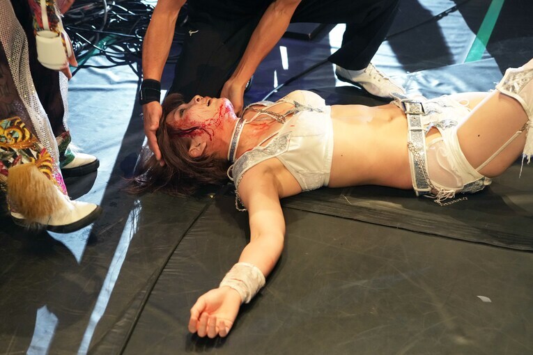 側頭部から流血した安納サオリ