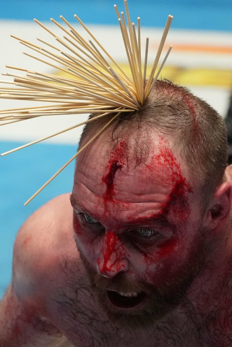 頭頂部に「竹串の花」が咲いたジョン・モクスリー