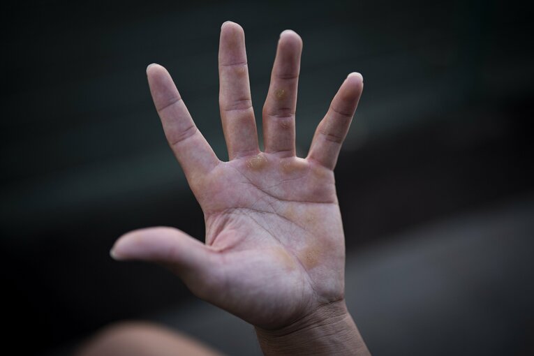 常松広太郎の「手」 ©Masaki Fujioka