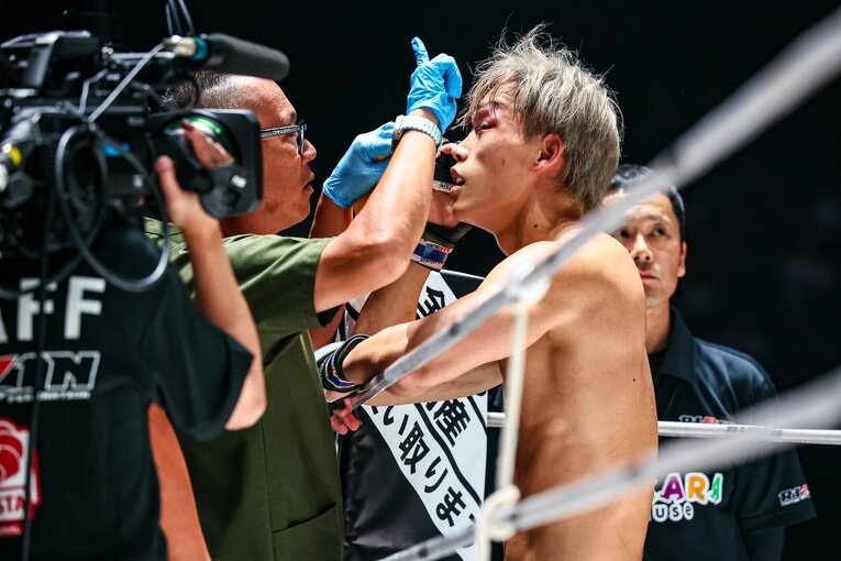 左目が完全に塞がった細川。ドクターストップ決着となった　©RIZIN FF Susumu Nagao