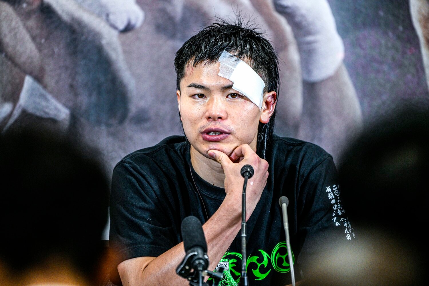 左目上をカットした那須川天心。試合後のコメントはこれまでのポジティブ発言とは異なっていた ©Takuya Sugiyama