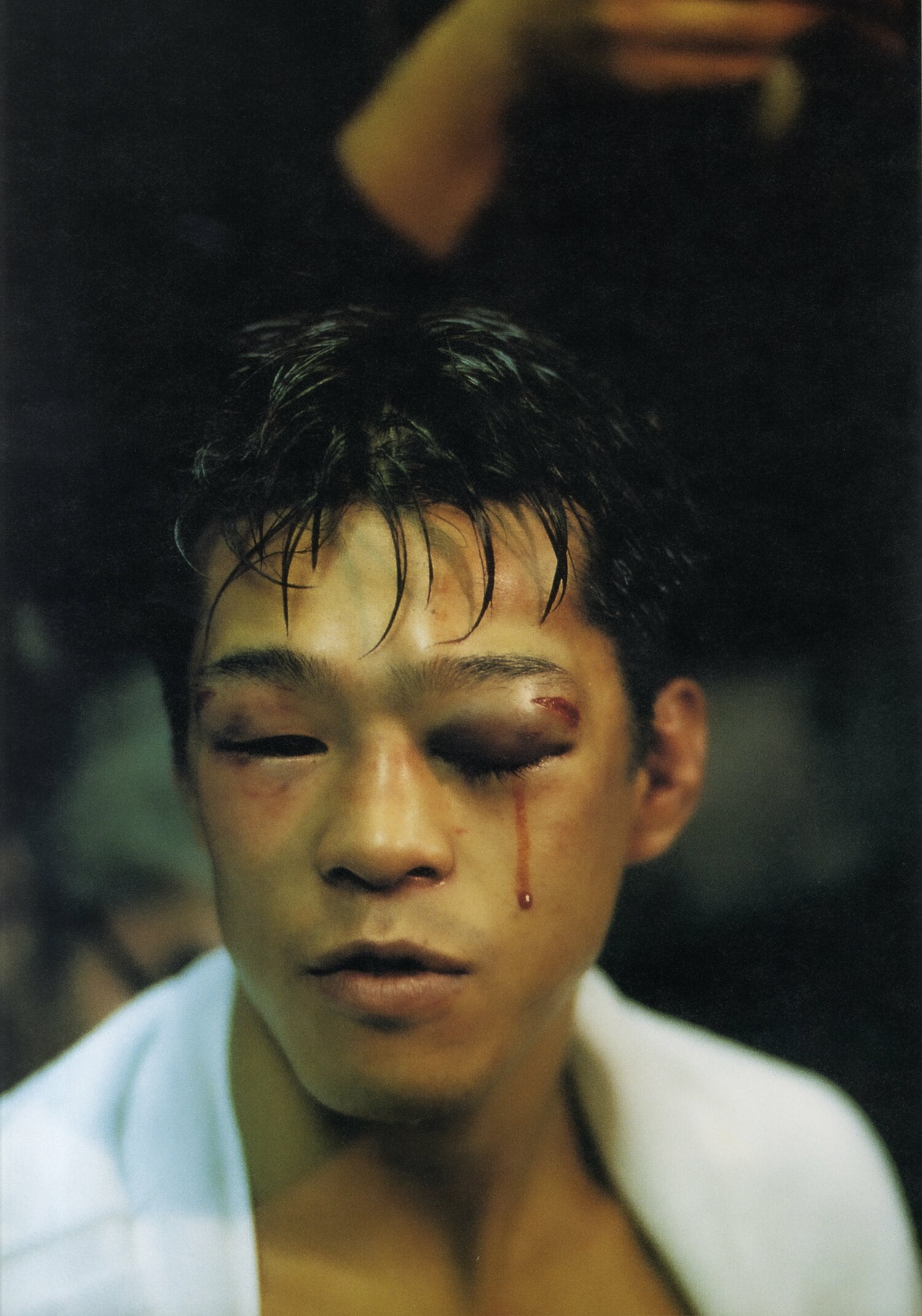 薬師寺保栄との日本人対決に敗れ、左目から血を流す辰吉丈一郎