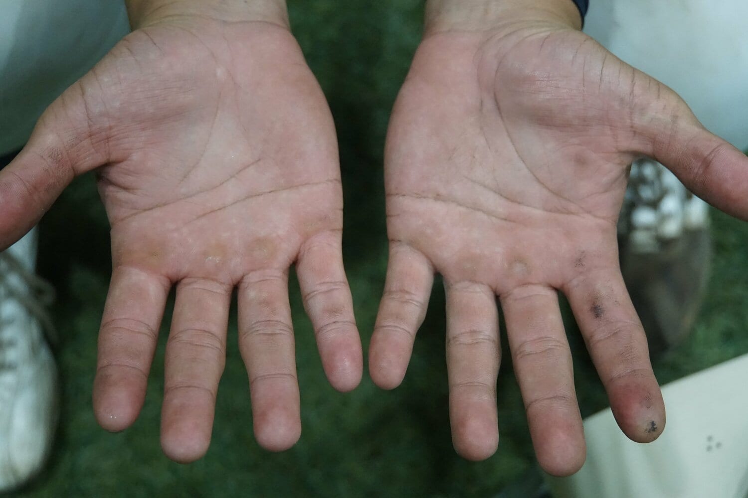 「分厚いって、よく言われます」。ドラフト候補・東松の手　©Kei Nakamura