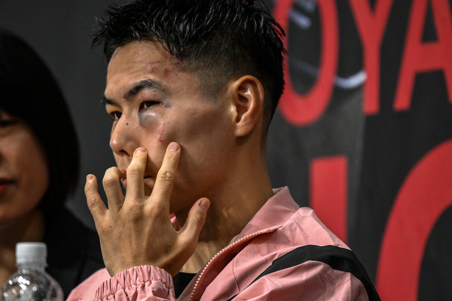 左目下の内出血が痛々しい ©Takuya Sugiyama