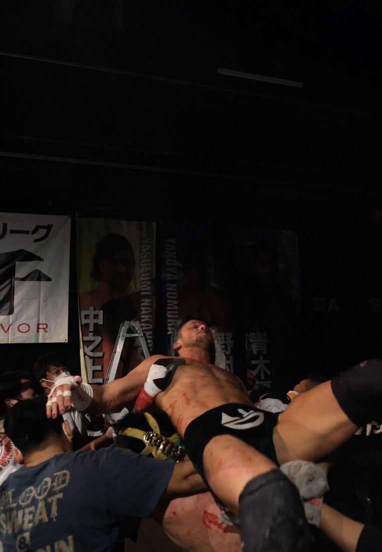 デスマッチファイター・ドリューは血がドクドク流れても試合を止めなかった 「ケガある、傷ある。でもやる。大好きだから」(61)