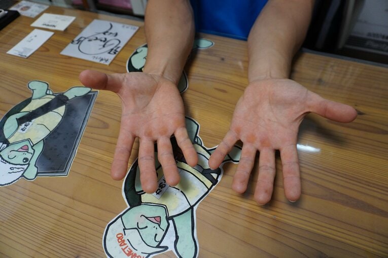 指の筋肉が特徴的な森本の手。トレーニングの影響で左手の方が大きいという　©NumberWeb