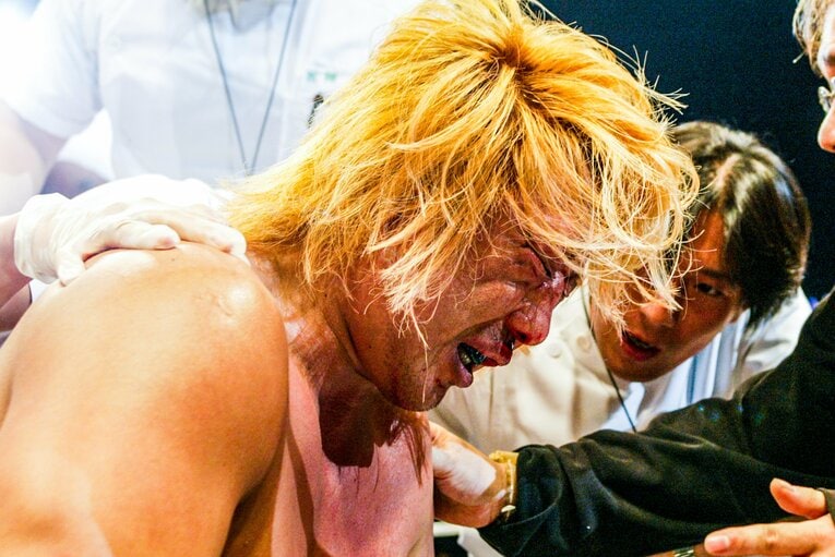 ボブ・サップに敗れ、顔が大きく腫れ上がった高山善廣