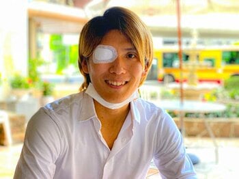 「ゼリー状の“それ”が自分の右目だと信じきっていた」失明危機に陥ったフットボーラー・松本光平が語る“光を失った瞬間”の激痛＜Number Web＞ photograph by Tetsuichi Utsunomiya