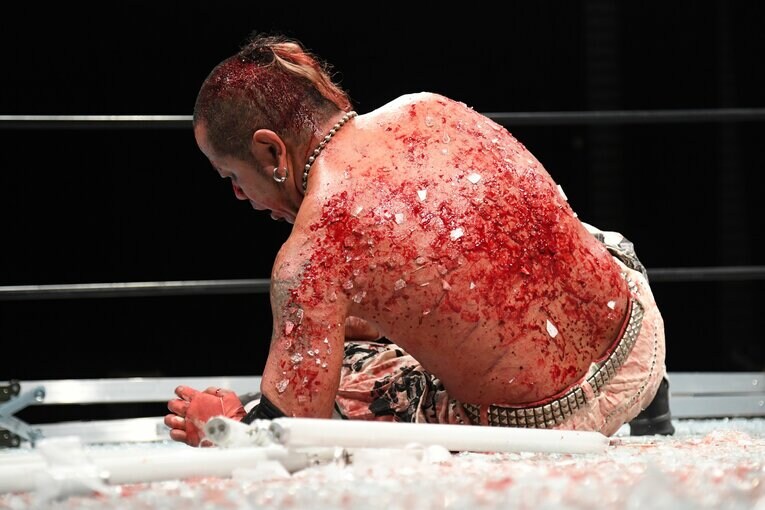 試合後、葛西の背中