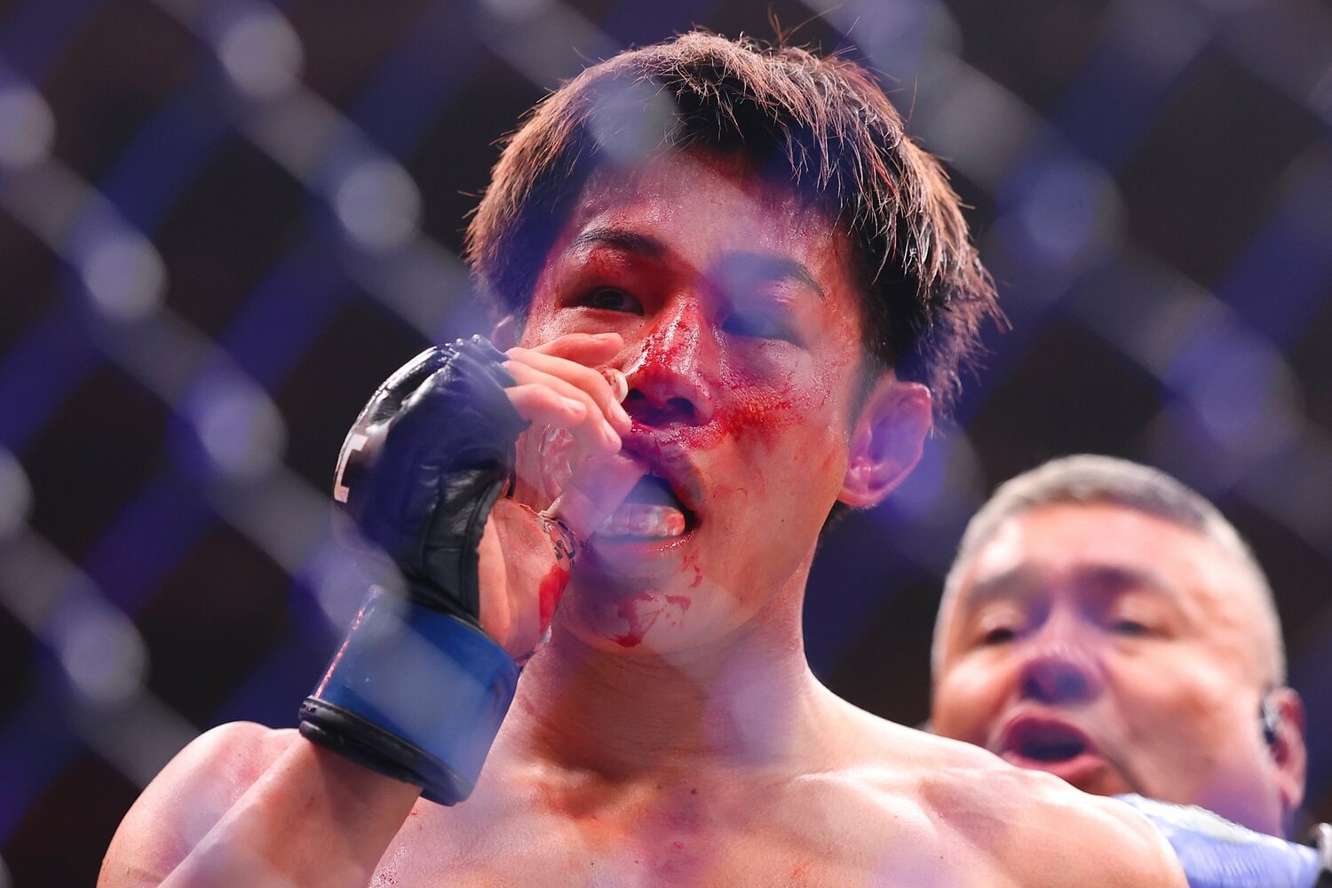 敗れた平良達郎。その顔は血で染まっていた　©Zuffa LLC/UFC