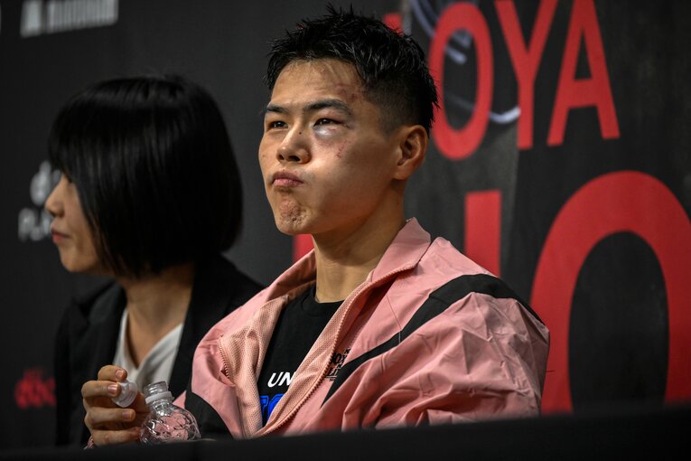 試合後のキム・イェジュン。左目のアザが痛々しい　©Takuya Sugiyama