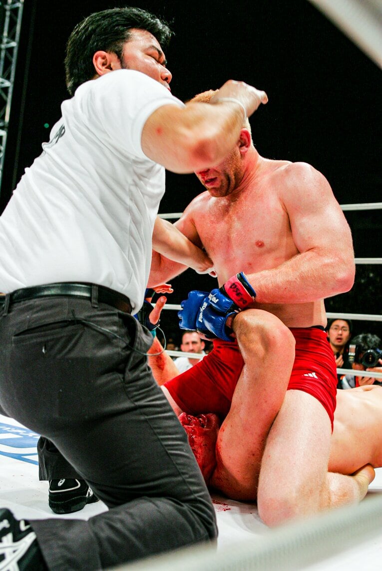 レフェリーが試合をストップ。シュルトの顔は血で染まっていた　©Susumu Nagao