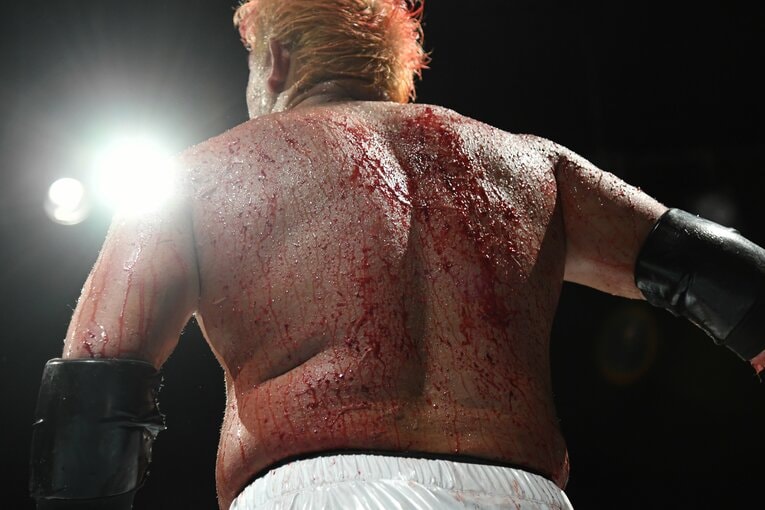 試合後、石川の背中