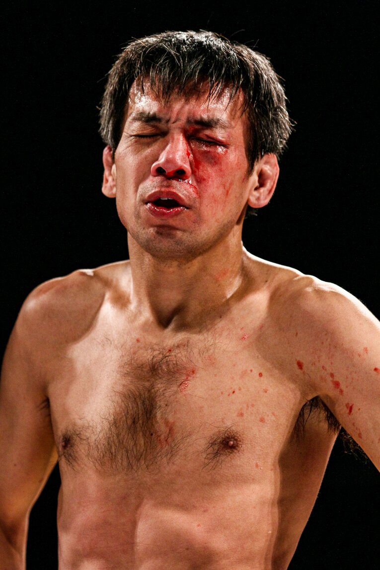 左目上を負傷し、判定で敗れた　©Susumu Nagao