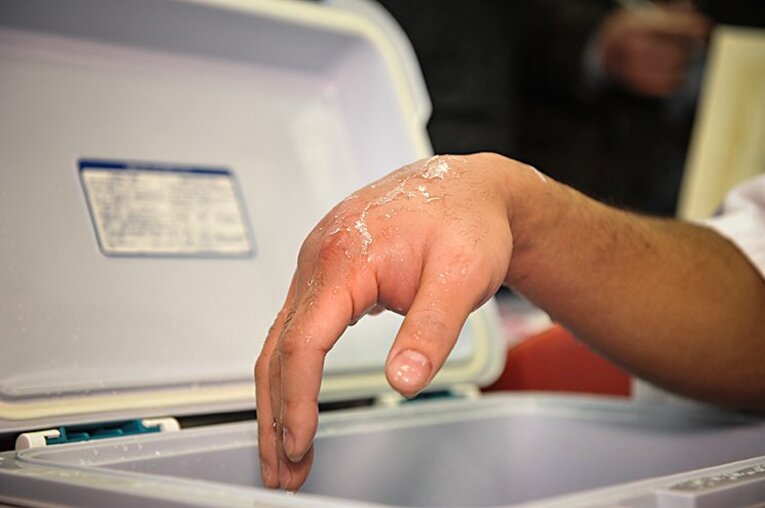 内山高志、TKO勝ち。両目とも腫れ、視界がない三浦隆司が「もう無理」。(2)