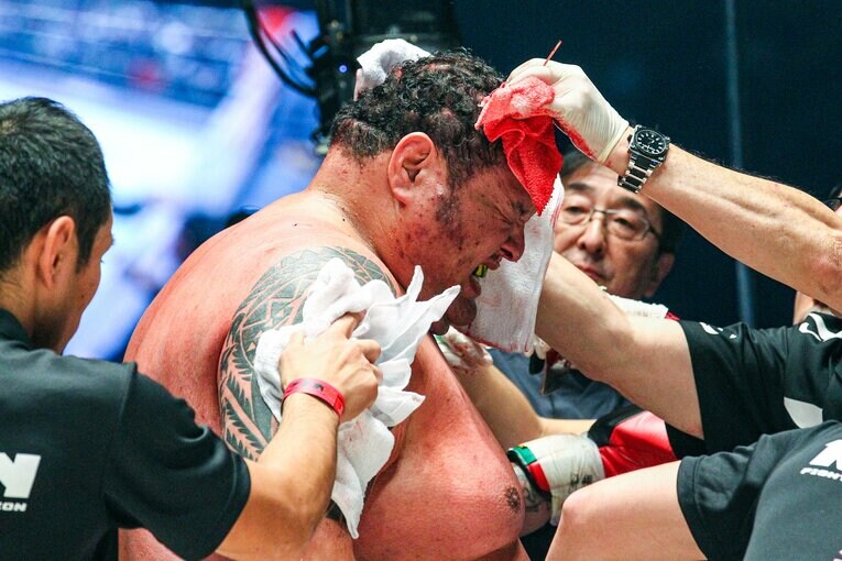流血が止まらず、無念のストップ　©RIZIN FF Susumu Nagao