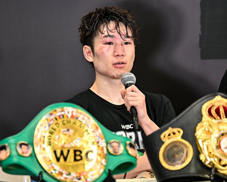 アザだらけの顔で試合後の会見に出席した寺地拳四朗　©Hiroaki Yamaguchi