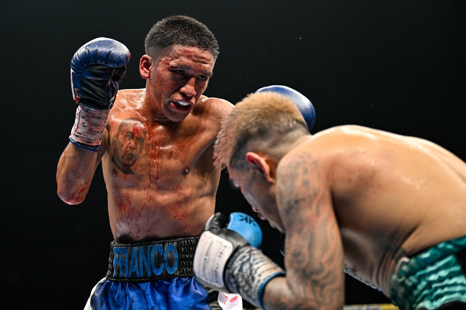 右目上から出血しながらフルラウンドを戦い抜いた27歳のフランコ。試合後、SNSで引退を表明した　©Hiroaki Yamaguchi