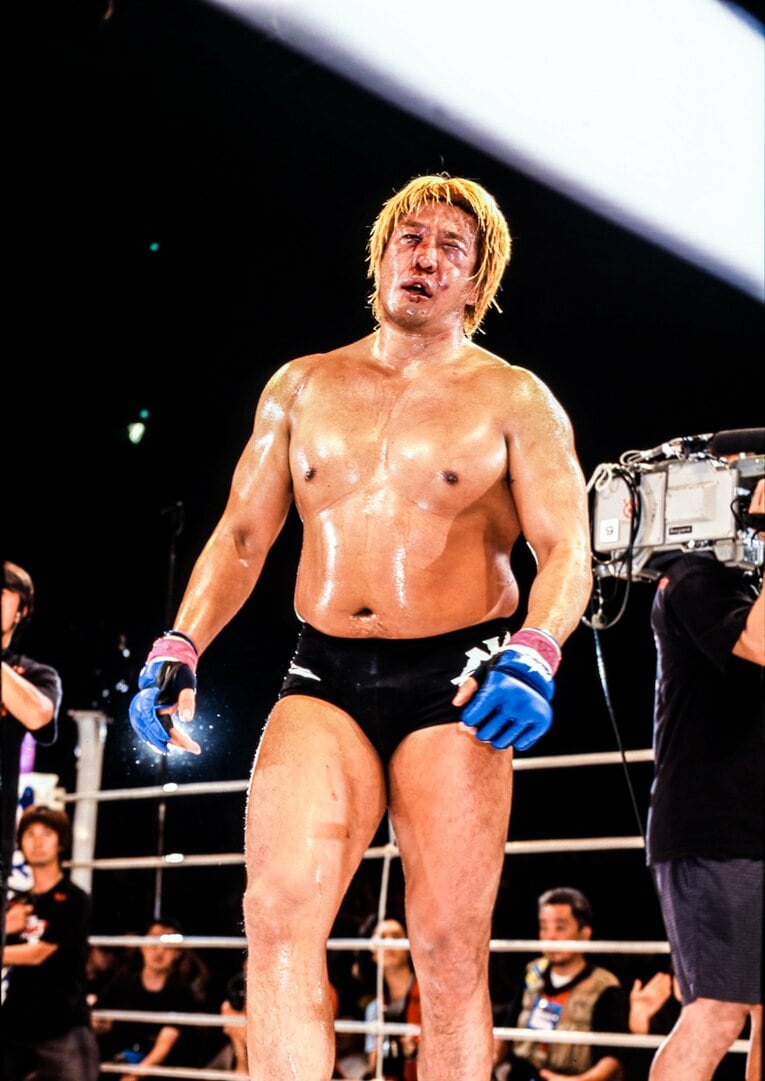 フライ戦後、数え切れないほどのパンチを被弾した高山の顔は原形を留めていなかった