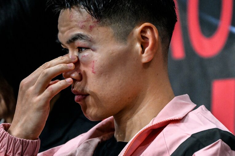 腫れた目元を気にするキム・イェジュン（32歳）　©Takuya Sugiyama