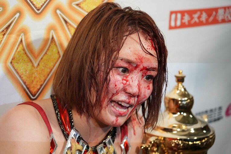 顔を血で染めて決意を語るSareee　©Essei Hara