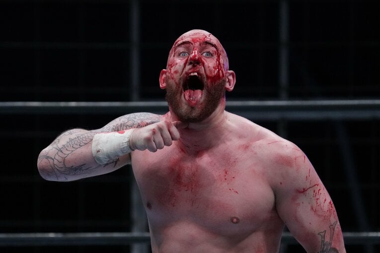 血だらけで絶叫するゲイブ・キッド　©Essei Hara