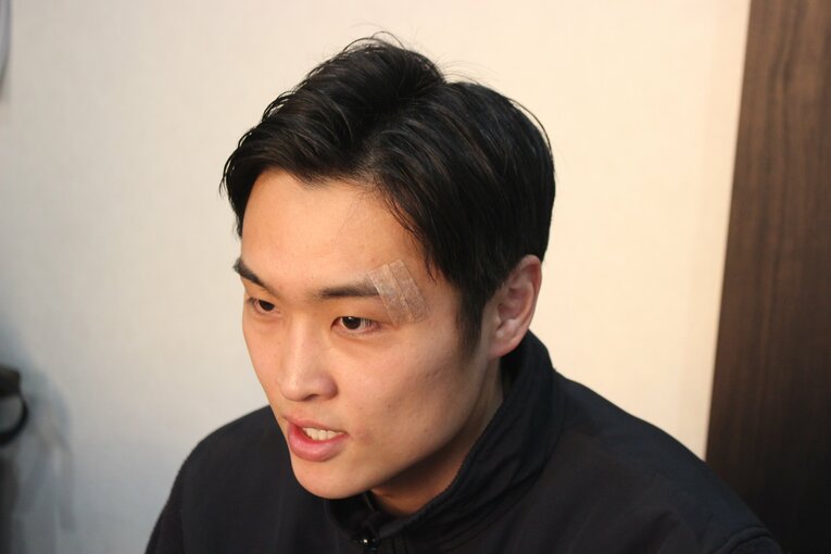 バスケス戦で左まぶたをカットした西田凌佑。取材時点ではまだ傷が残っていた　©Number Web
