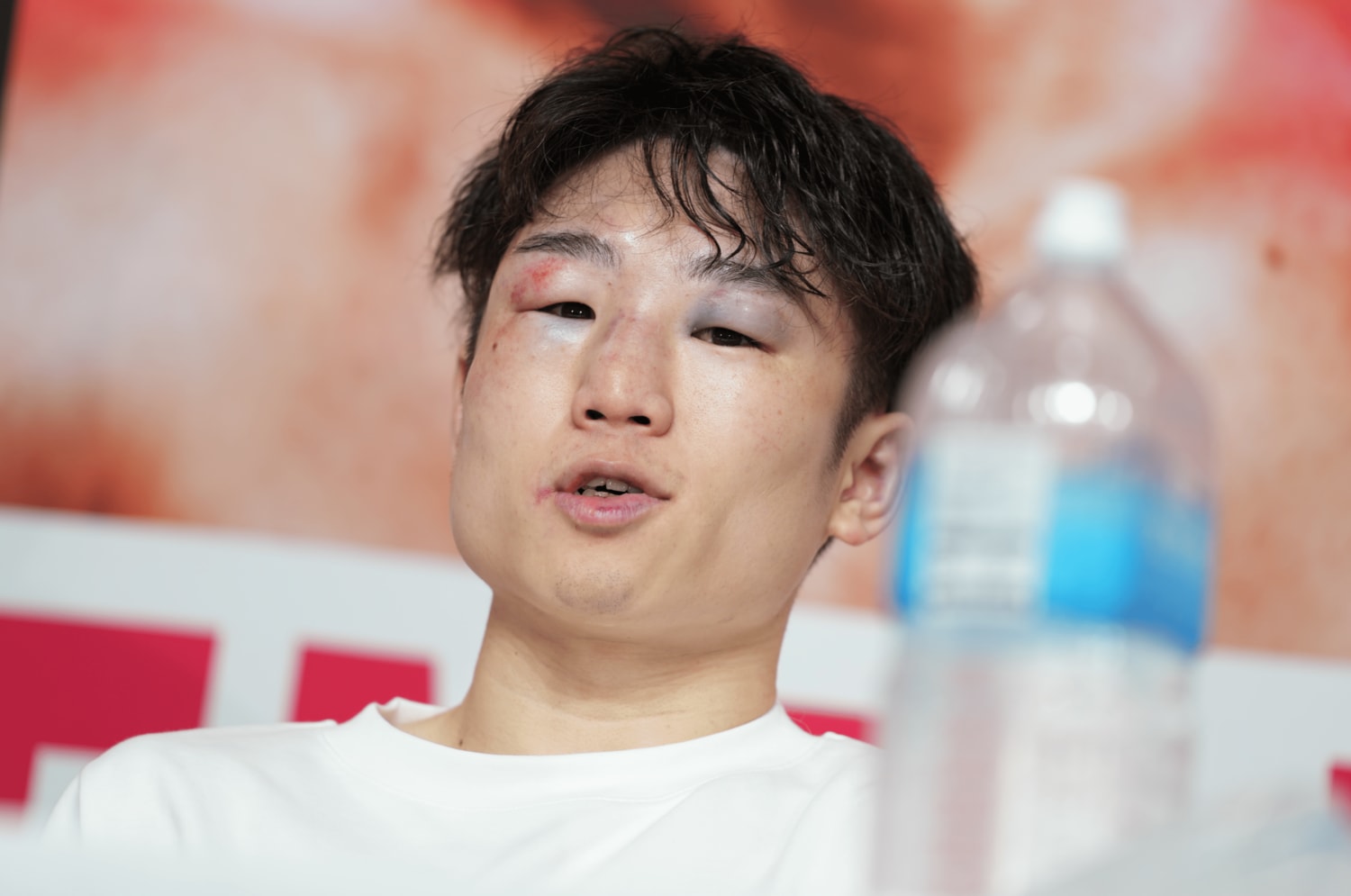 「“このまま引退”はない」寺地拳四朗33歳を倒した“苦労人”サンドバルとは何者？「すぐに簡単な試合にならないと感じた」英国人記者も嘆いた予想外の結末＜Number Web＞ photograph by Naoki Kitagawa