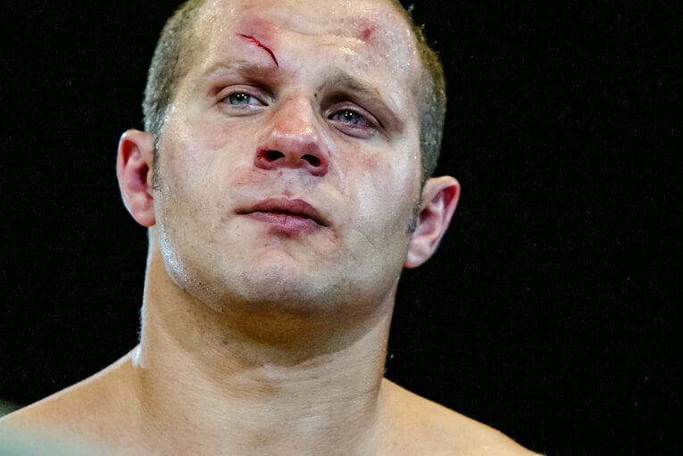 深くカットされたヒョードルの額。試合はノーコンテストとなった