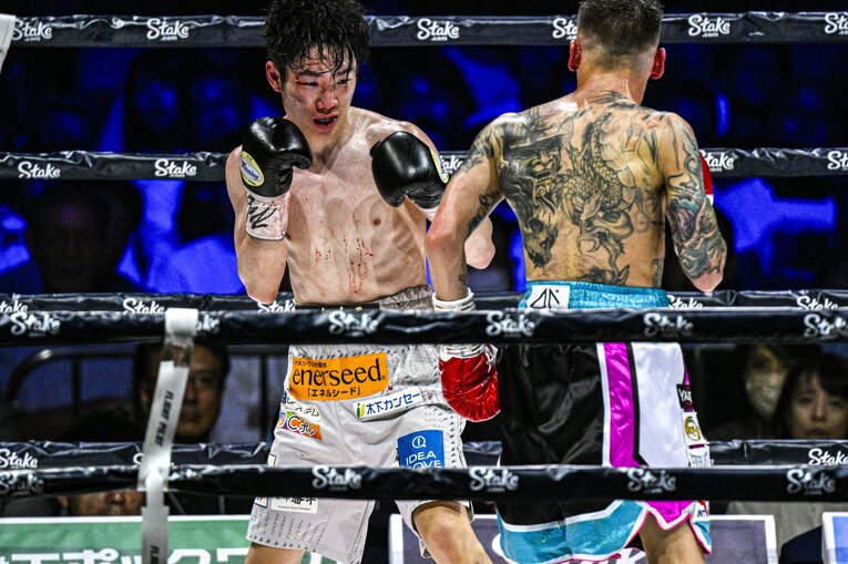 バッティングによって出血した寺地拳四朗　©Takuya Sugiyama