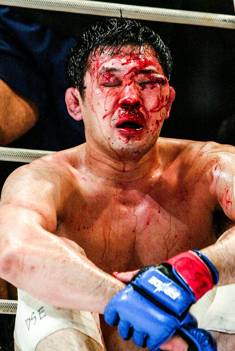 顔が変形するほどのダメージを負い、血だらけになった桜庭の姿に、多くのファンがショックを受けた