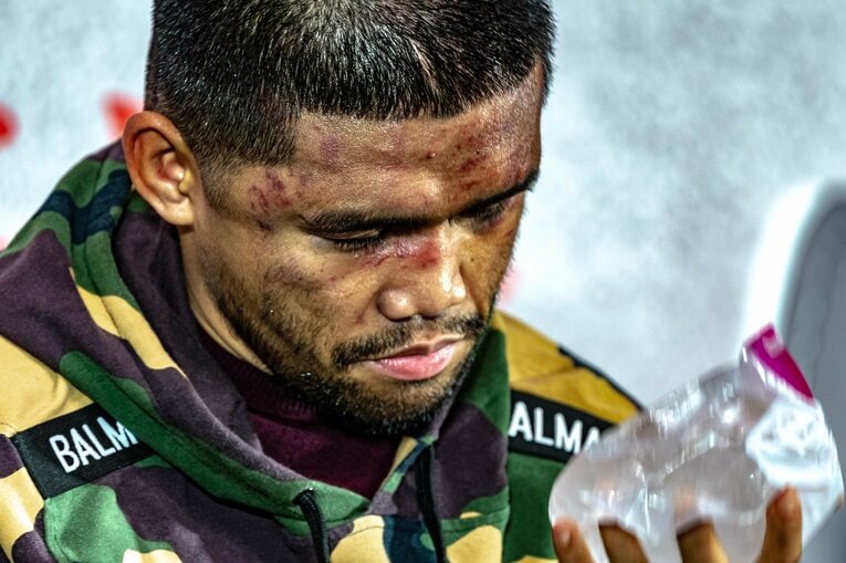 氷のうを手にするタパレス　©Takuya Sugiyama