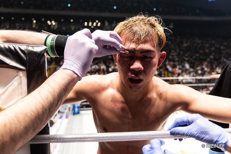 YA-MANの傷口は深く、試合後に「4針縫った」と明かした　©RIZIN FF